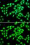 Protein-L-Isoaspartate (D-Aspartate) O-Methyltransferase antibody, GTX33392, GeneTex, Immunofluorescence image 
