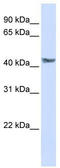 Pyruvate Dehydrogenase Kinase 3 antibody, TA339280, Origene, Western Blot image 