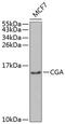  antibody, GTX53936, GeneTex, Western Blot image 
