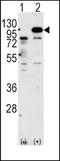 Amyloid Beta Precursor Protein antibody, TA300060, Origene, Western Blot image 