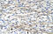 Four And A Half LIM Domains 2 antibody, 28-112, ProSci, Immunohistochemistry paraffin image 