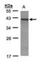 Cyclin-dependent kinase 20 antibody, GTX105199, GeneTex, Western Blot image 