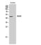 Dihydroorotate dehydrogenase, mitochondrial antibody, STJ92710, St John