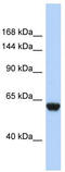Complement factor H-related protein 4 antibody, TA346027, Origene, Western Blot image 