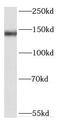 DEAH-Box Helicase 38 antibody, FNab02381, FineTest, Western Blot image 