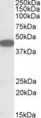C-X-C Motif Chemokine Receptor 6 antibody, TA311368, Origene, Western Blot image 
