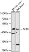C-C Motif Chemokine Receptor 8 antibody, GTX55553, GeneTex, Western Blot image 