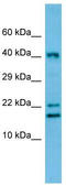 CAMP Responsive Element Modulator antibody, TA337722, Origene, Western Blot image 