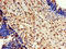Eukaryotic Elongation Factor 2 Kinase antibody, A62458-100, Epigentek, Immunohistochemistry paraffin image 