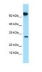 FKBP Prolyl Isomerase 10 antibody, NBP1-98561, Novus Biologicals, Western Blot image 