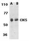 Prolactin Induced Protein antibody, orb19224, Biorbyt, Western Blot image 