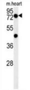 Putative Homeodomain Transcription Factor 2 antibody, AP53290PU-N, Origene, Western Blot image 