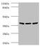 Isocitrate Dehydrogenase (NAD(+)) 3 Beta antibody, A53686-100, Epigentek, Western Blot image 