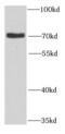 Myotubularin Related Protein 14 antibody, FNab05408, FineTest, Western Blot image 