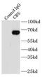 Cystathionine beta-synthase antibody, FNab01327, FineTest, Immunoprecipitation image 