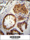Ubiquitin Conjugating Enzyme E2 S antibody, 61-083, ProSci, Immunohistochemistry frozen image 