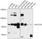 Guanylate cyclase soluble subunit alpha-3 antibody, GTX66113, GeneTex, Western Blot image 