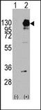 Platelet Derived Growth Factor Receptor Alpha antibody, AP14398PU-N, Origene, Western Blot image 