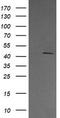 Mitogen-Activated Protein Kinase Kinase 1 antibody, TA506036BM, Origene, Western Blot image 