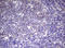 Enhancer Of Zeste 2 Polycomb Repressive Complex 2 Subunit antibody, LS-C336768, Lifespan Biosciences, Immunohistochemistry frozen image 