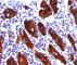 Thyroglobulin antibody, V2262SAF-100UG, NSJ Bioreagents, Immunohistochemistry paraffin image 