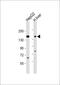 Canalicular multispecific organic anion transporter 2 antibody, 55-057, ProSci, Western Blot image 