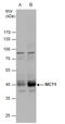 Monocarboxylate transporter 1 antibody, GTX129599, GeneTex, Western Blot image 