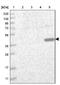 Chromosome 3 Open Reading Frame 33 antibody, NBP1-90874, Novus Biologicals, Western Blot image 