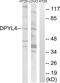 Dihydropyrimidinase Like 4 antibody, PA5-39134, Invitrogen Antibodies, Western Blot image 