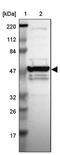 Zinc Finger Protein 764 antibody, PA5-51858, Invitrogen Antibodies, Western Blot image 