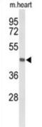 Deleted in bladder cancer protein 1 antibody, abx034381, Abbexa, Western Blot image 