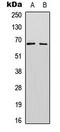 Splicing Factor 1 antibody, GTX55031, GeneTex, Western Blot image 