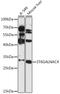 ST6 N-Acetylgalactosaminide Alpha-2,6-Sialyltransferase 4 antibody, LS-C747950, Lifespan Biosciences, Western Blot image 
