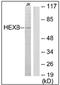Beta-N-acetylhexosaminidase subunit beta antibody, AP32247PU-N, Origene, Western Blot image 