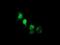 Non-Homologous End Joining Factor 1 antibody, GTX84043, GeneTex, Immunocytochemistry image 
