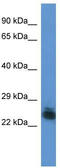 Forty-Two-Three Domain Containing 1 antibody, TA342956, Origene, Western Blot image 