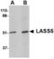 Ceramide Synthase 5 antibody, TA306688, Origene, Western Blot image 