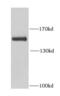 Renal carcinoma antigen NY-REN-26 antibody, FNab00854, FineTest, Western Blot image 