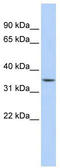 Chromosome 1 Open Reading Frame 116 antibody, TA346141, Origene, Western Blot image 