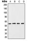 Casein Kinase 1 Gamma 3 antibody, GTX56261, GeneTex, Western Blot image 