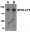 PH Domain And Leucine Rich Repeat Protein Phosphatase 1 antibody, 7019, ProSci, Western Blot image 