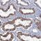 Leucine Rich Repeats And IQ Motif Containing 4 antibody, HPA036706, Atlas Antibodies, Immunohistochemistry paraffin image 