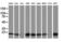 Destrin, Actin Depolymerizing Factor antibody, M03849, Boster Biological Technology, Western Blot image 