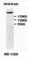p53BP1 antibody, orb77603, Biorbyt, Western Blot image 