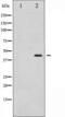 Mitogen-Activated Protein Kinase Kinase 1 antibody, TA325637, Origene, Western Blot image 