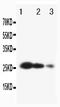 TIMP Metallopeptidase Inhibitor 3 antibody, PA1077, Boster Biological Technology, Western Blot image 