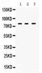 DNA Polymerase Eta antibody, PB9813, Boster Biological Technology, Western Blot image 