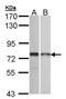 Zinc Finger Protein 398 antibody, PA5-21828, Invitrogen Antibodies, Western Blot image 