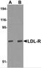 Low Density Lipoprotein Receptor antibody, 5163, ProSci, Western Blot image 