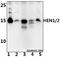 Helix-loop-helix protein 2 antibody, GTX66872, GeneTex, Western Blot image 